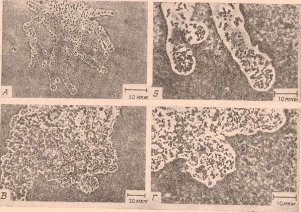 Микрофотография некоторых микроорганизмов активного ила