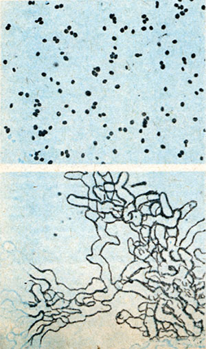 Дрожжи (вверху) и грибница «пенило» (вниз у), снятые под микроскопом при одинаковом увеличении